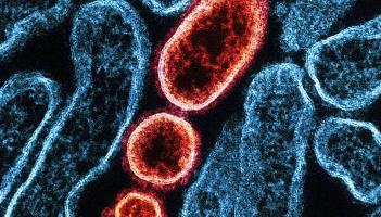 Exeter AI project secures &pound;300k Government funding to detect hospital infections before symptoms appear