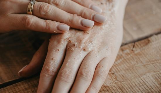 Devon health officials warn scabies cases could rise in Exeter