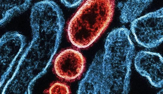 Exeter AI project secures &pound;300k Government funding to detect hospital infections before symptoms appear