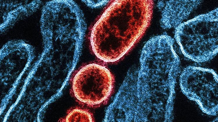 Exeter AI project secures &pound;300k Government funding to detect hospital infections before symptoms appear